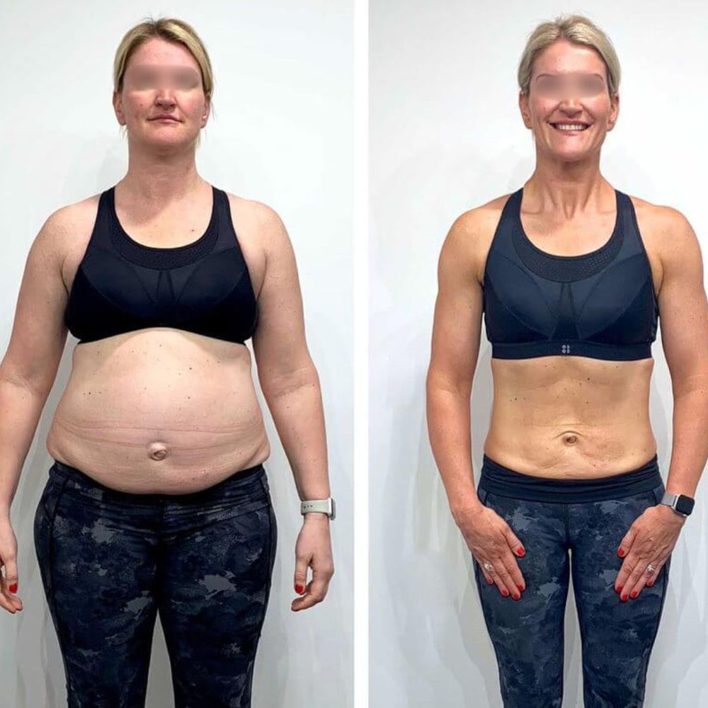 <h4>Resultados reales de nuestras clientas</h4>