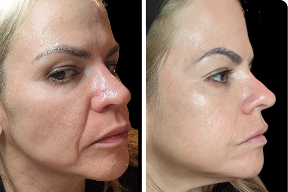 <h3>Nuestras clientas</h3>