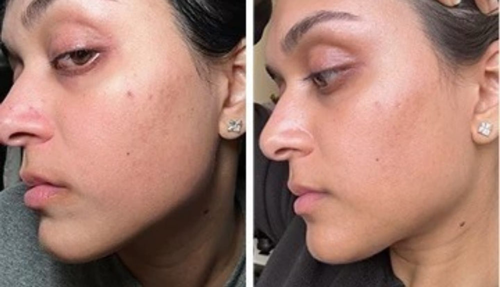 <h3>Nuestras clientas</h3>